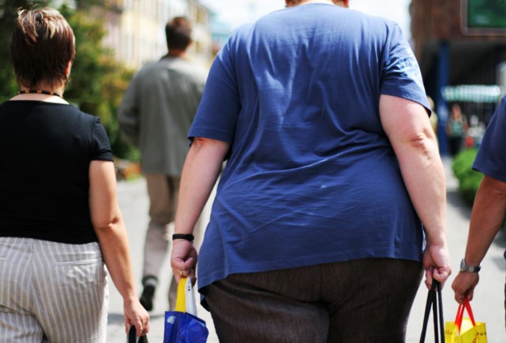 Obesity/Overweight Affects Brain Health Negatively
